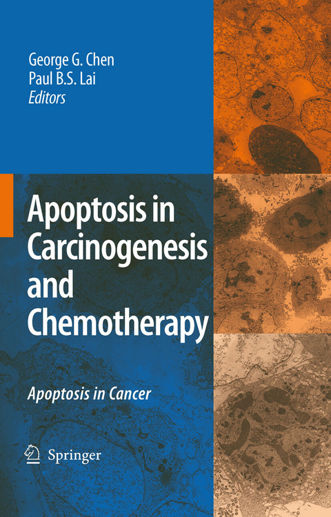 Apoptosis in Carcinogenesis and Chemotherapy - 