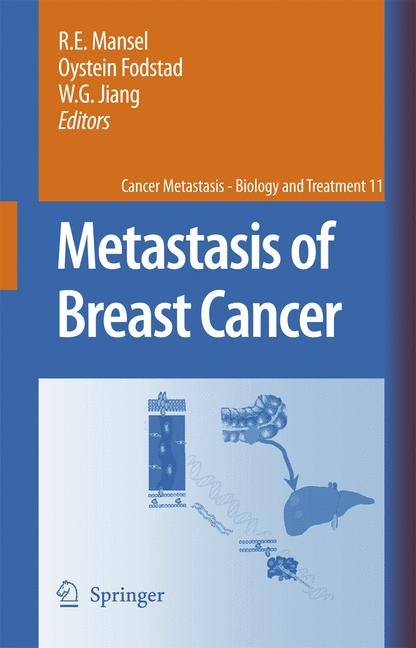 Metastasis of Breast Cancer - 