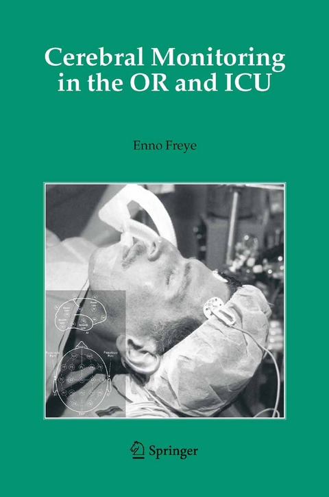 Cerebral Monitoring in the OR and ICU - 