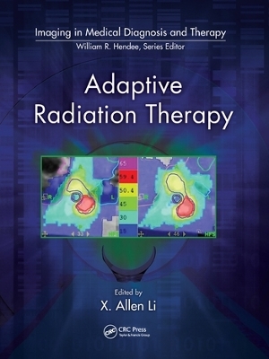 Adaptive Radiation Therapy - 