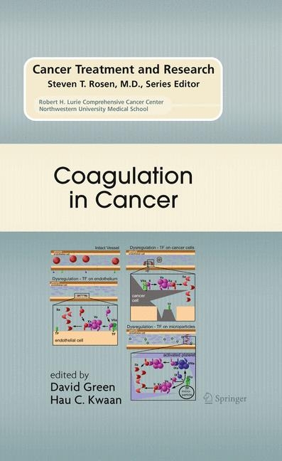 Coagulation in Cancer - 