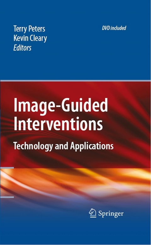 Image-Guided Interventions - 