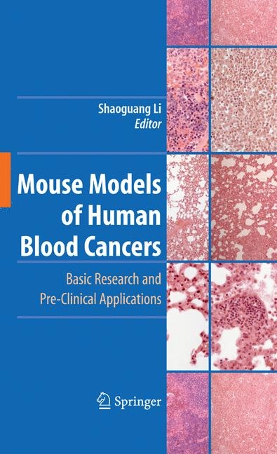 Mouse Models of Human Blood Cancers - 