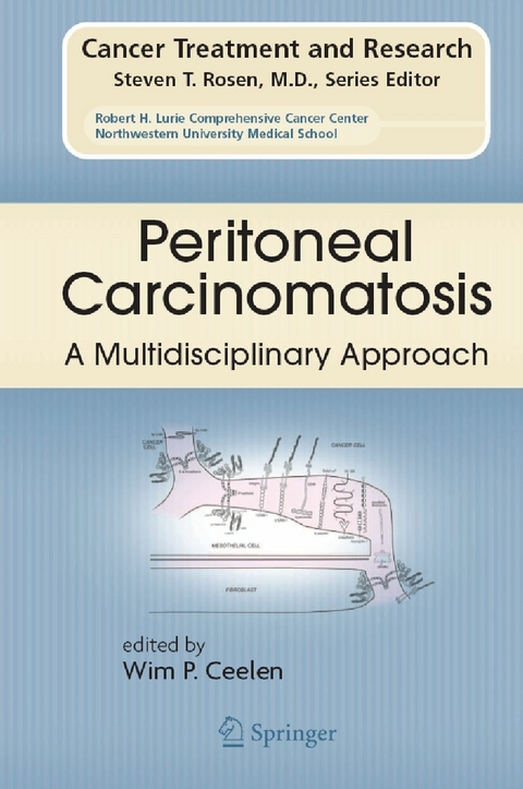 Peritoneal Carcinomatosis: A Multidisciplinary Approach - 