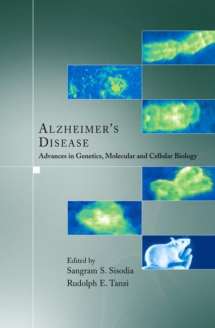 Alzheimer's Disease - 