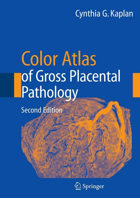 Color Atlas of Gross Placental Pathology -  Cynthia G. Kaplan