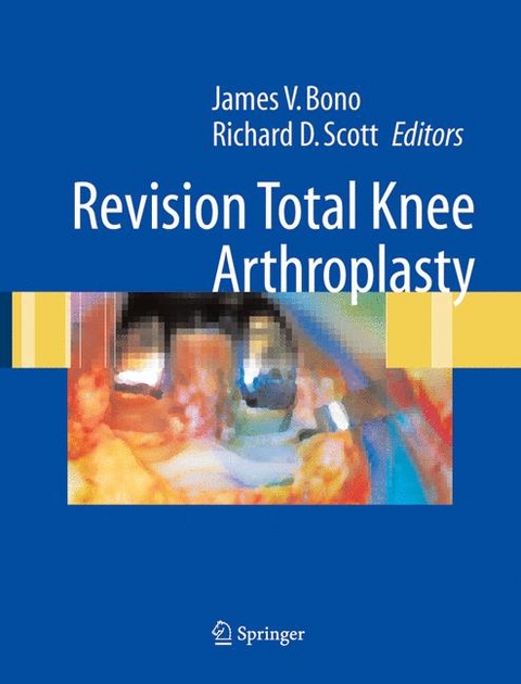 Revision Total Knee Arthroplasty - 