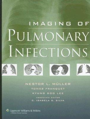 Imaging of Pulmonary Infections - 