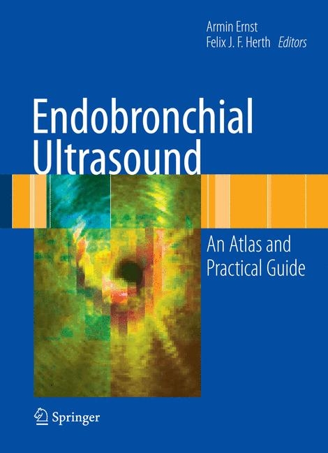 Endobronchial Ultrasound - 
