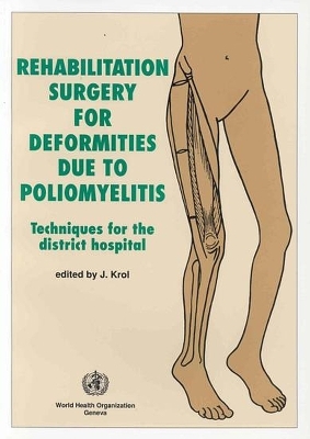 Rehabilitation surgery for deformities due to poliomyelitis -  World Health Organization