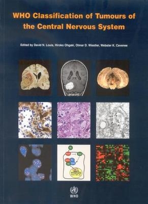 WHO Classification of Tumours of the Central Nervous System -  International Agency for Research on Cancer, W. K. Cavenee, H. Ohgaki, Otmar D. Wiestler