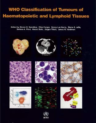WHO classification of tumours of haematopoietic and lymphoid tissues - S.H Swerdlow,  International Agency for Research on Cancer
