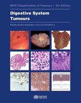 WHO Classification of Tumours. Digestive System Tumours - 
