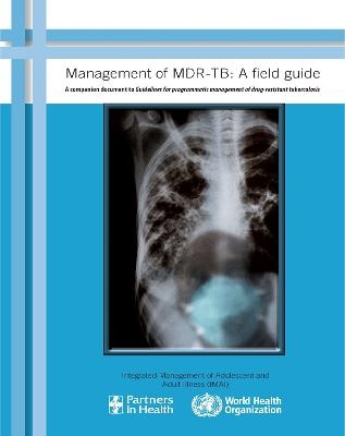Management of MDR-TB - 