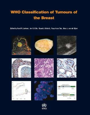 WHO Classification of Tumours of the Breast