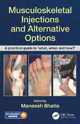 Musculoskeletal Injections and Alternative Options - 