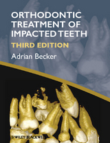 Orthodontic Treatment of Impacted Teeth -  Adrian Becker