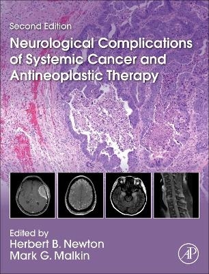 Neurological Complications of Systemic Cancer and Antineoplastic Therapy - 