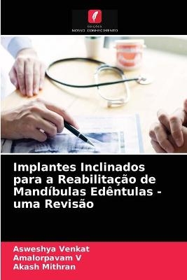 Implantes Inclinados para a Reabilitação de Mandíbulas Edêntulas - uma Revisão - Asweshya Venkat, Amalorpavam V, Akash Mithran