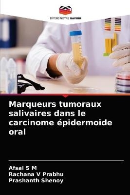 Marqueurs tumoraux salivaires dans le carcinome épidermoïde oral - Afsal S M, Rachana V Prabhu, Prashanth Shenoy