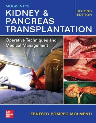 Molmenti's Kidney and Pancreas Transplantation: Operative Techniques and Medical Management - Ernesto P. Molmenti