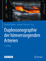 Duplexsonographie der hirnversorgenden Arterien - 