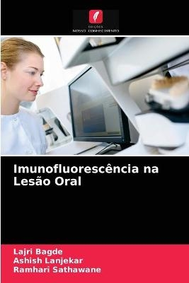 Imunofluorescência na Lesão Oral - Lajri Bagde, Ashish Lanjekar, Ramhari Sathawane