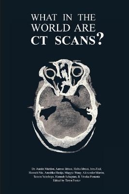 What in the World are CT Scans? - Austin Mardon, Aamna Idrees, Hafsa Idrees