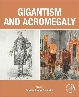 Gigantism and Acromegaly - 