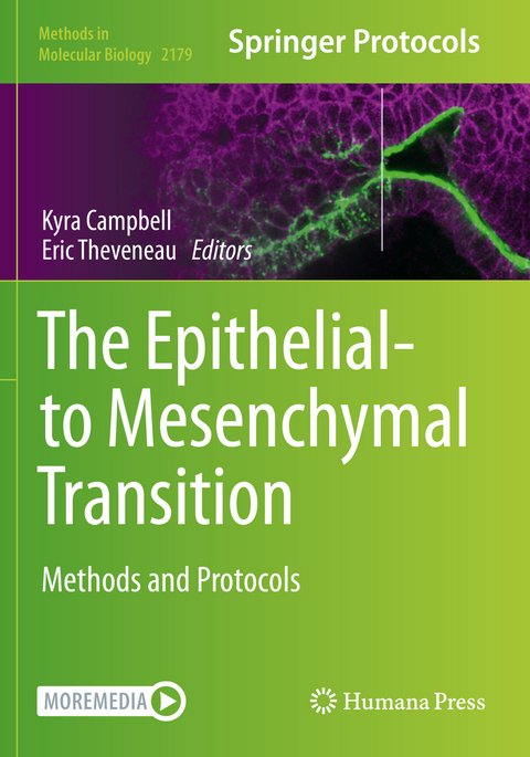 The Epithelial-to Mesenchymal Transition - 