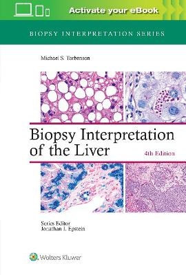 Biopsy Interpretation of the Liver - Michael Torbenson