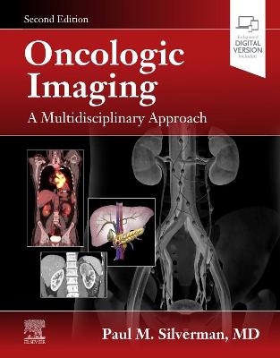 Oncologic Imaging: A Multidisciplinary Approach - 