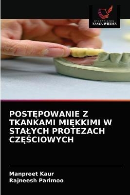 PostĘpowanie Z Tkankami MiĘkkimi W Stalych Protezach CzĘŚciowych - Manpreet Kaur, Rajneesh Parimoo